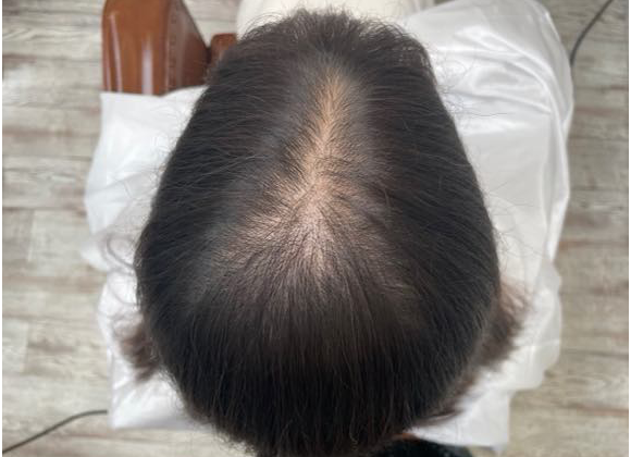 after